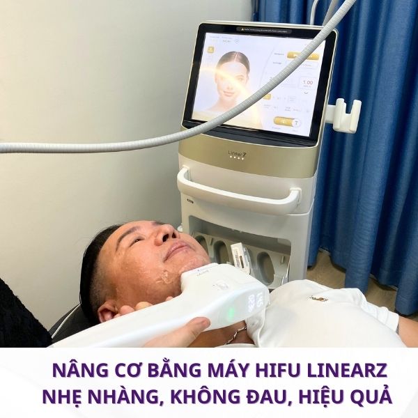 HIFU Có Đau Không? Trải nghiệm thực tế quy trình nâng cơ bằng máy HIFU LinearZ