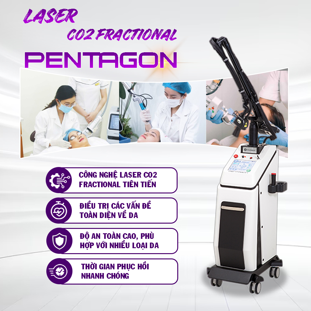 Ưu điểm vượt trội của Laser CO2 Pentagon