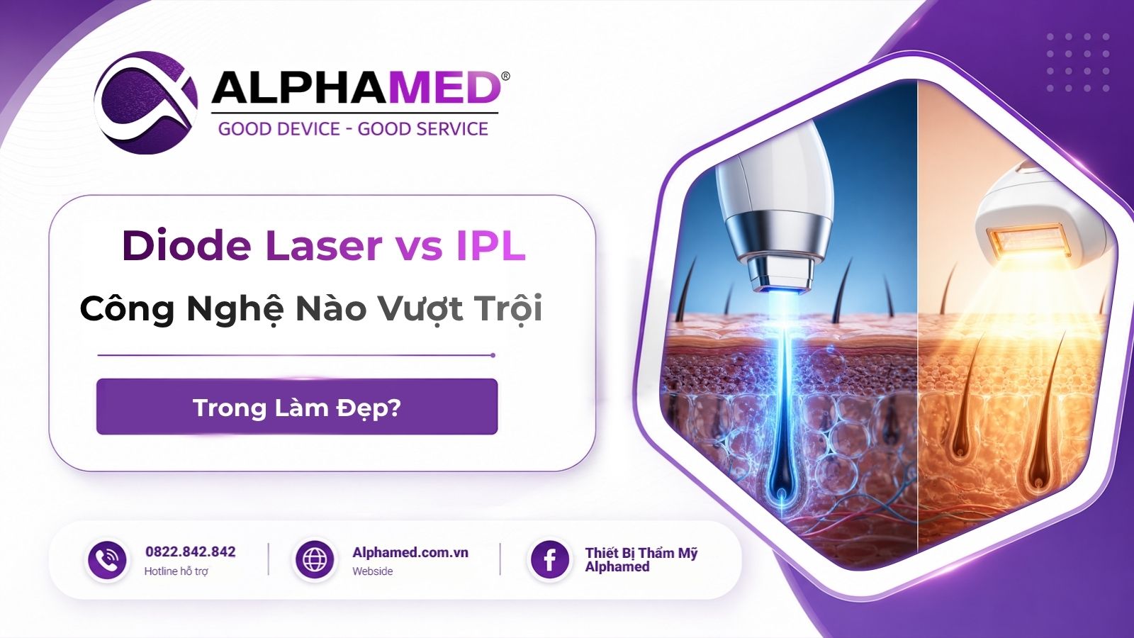 Diode Laser vs IPL