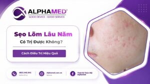 Sẹo Lõm Lâu Năm Có Trị Được Không? Cách Điều Trị Hiệu Quả