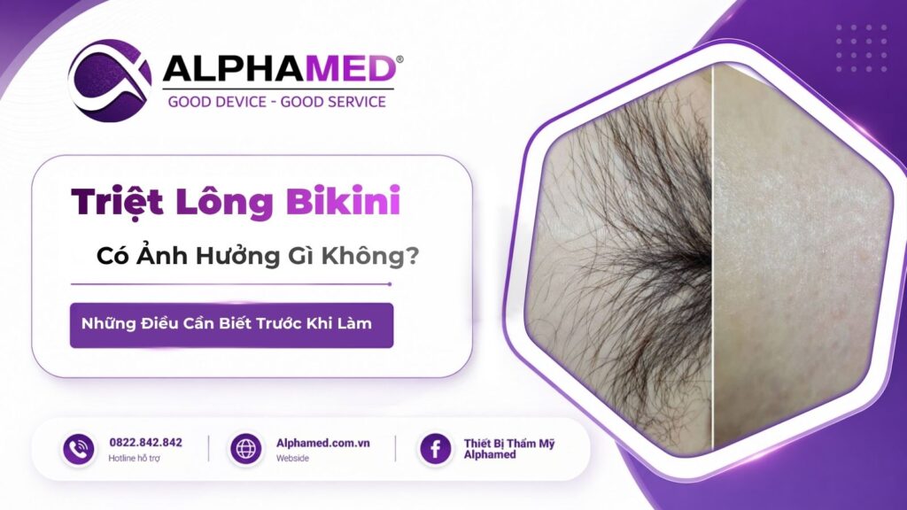 Triệt Lông Bikini Có Ảnh Hưởng Gì Không? Những Điều Cần Biết Trước Khi Làm