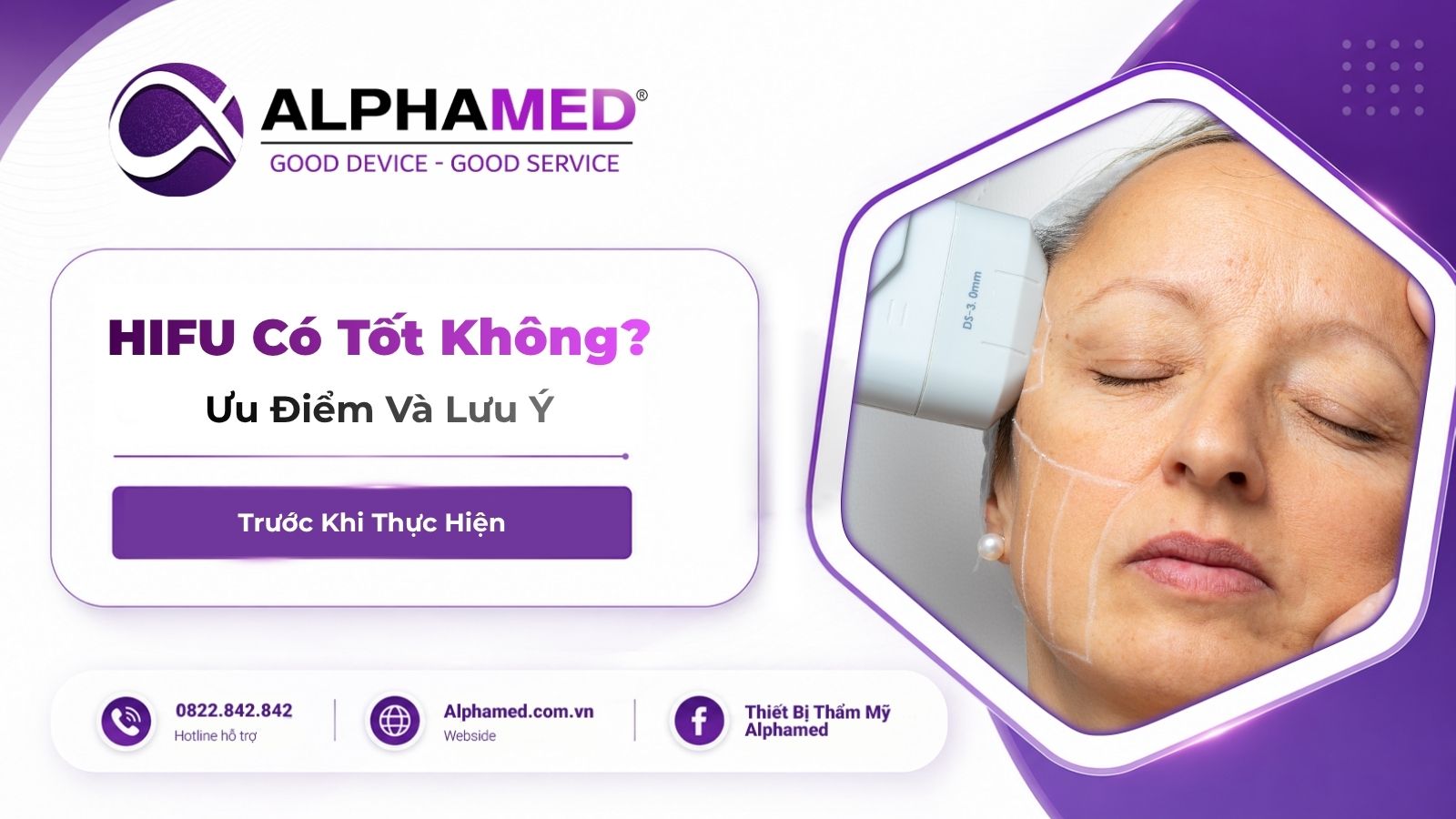 HIFU Có Tốt Không? Ưu Điểm Và Lưu Ý Trước Khi Thực Hiện